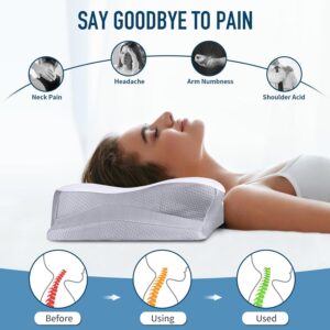 Memory Foam Pillows Cervical Neck Pillow for Neck Pain Relief, Contour Cooling Bed Pillow for Sleeping, Odorless Ergonomic Orthopedic Neck Support Pillows for Side Back Stomach Sleeper with Pillowcase